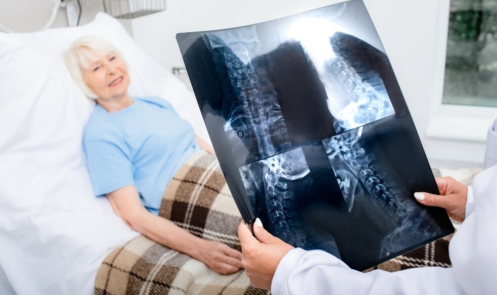 Osteochondrose-Diagnose