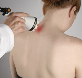 Die Lasertherapie hilft, Entzündungen zu lindern und die Geweberegeneration im Nacken zu aktivieren. 