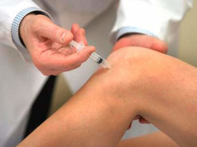 Die intraartikuläre Injektion ist eine der fortschrittlichsten Behandlungsformen bei Arthrose des Kniegelenks. 