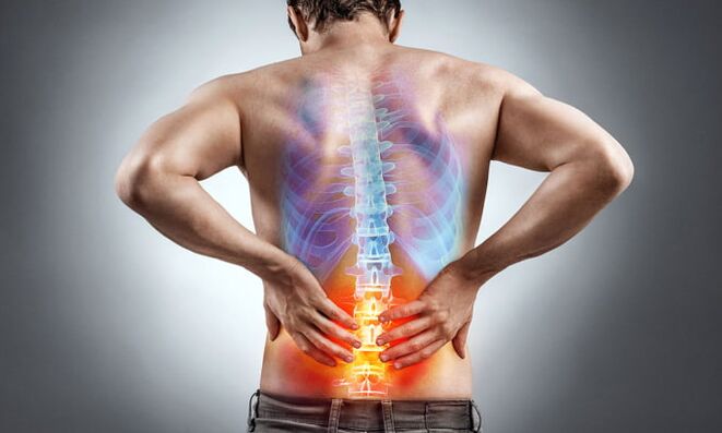 Ursachen für Rückenschmerzen