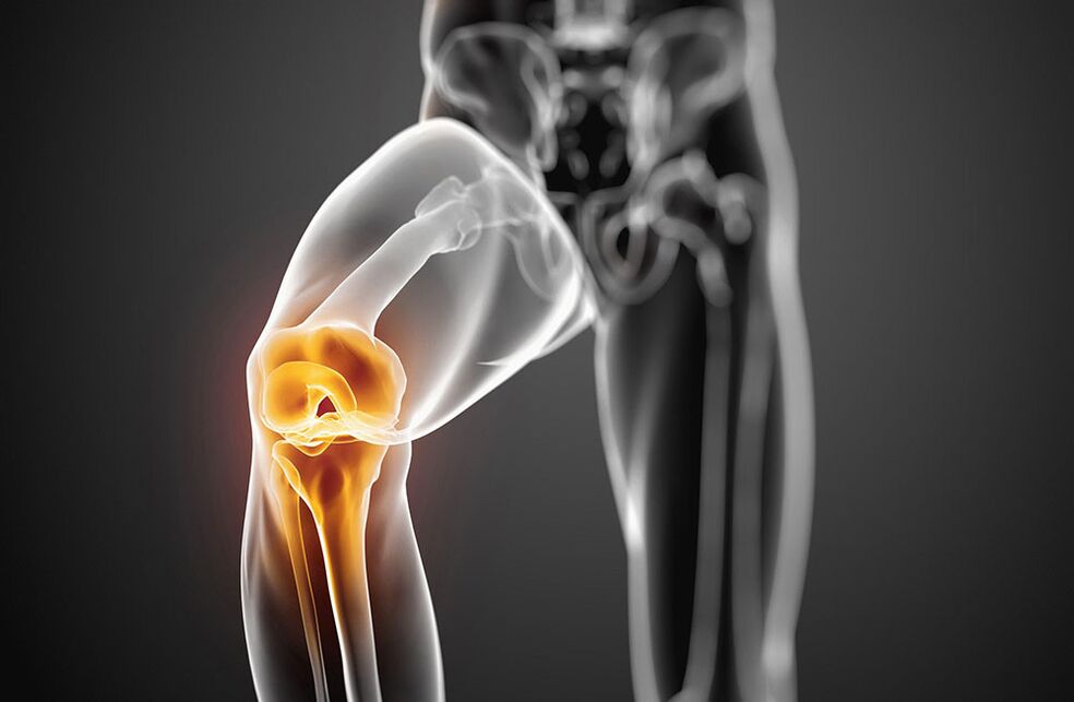 Kniegelenks -Osteoarthritis