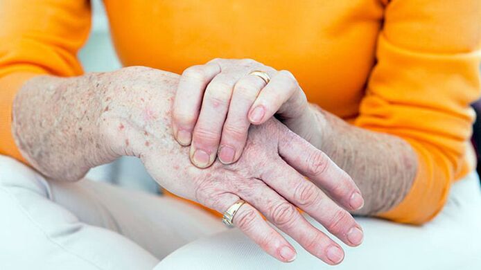 Pinselosteoarthritis