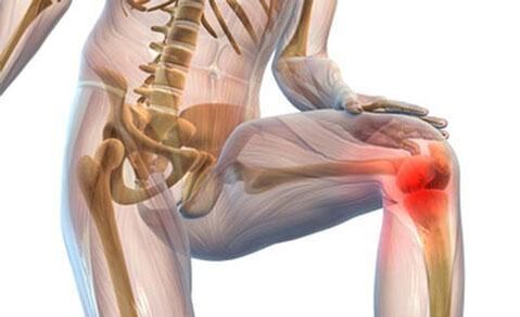 Kniegelenks -Osteoarthritis