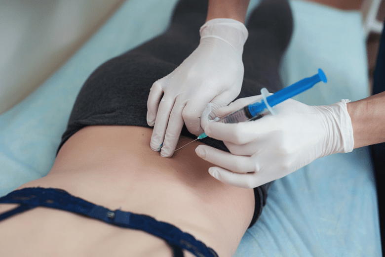 Block für lumbale Osteochondrose